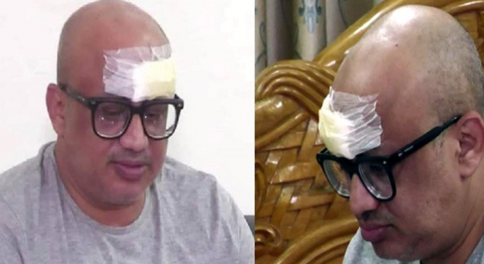 আল্লাহ নিজে আমাকে বাঁচিয়েছেন : ডা. মুরাদ